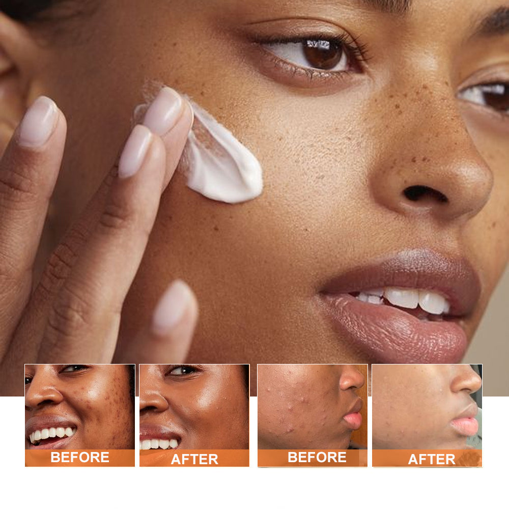 PHISYA Turmeric Clay Face Mask – Pore-Refining & Firming Treatment with Botanical Extracts for Clear, Radiant Skin PHISYA