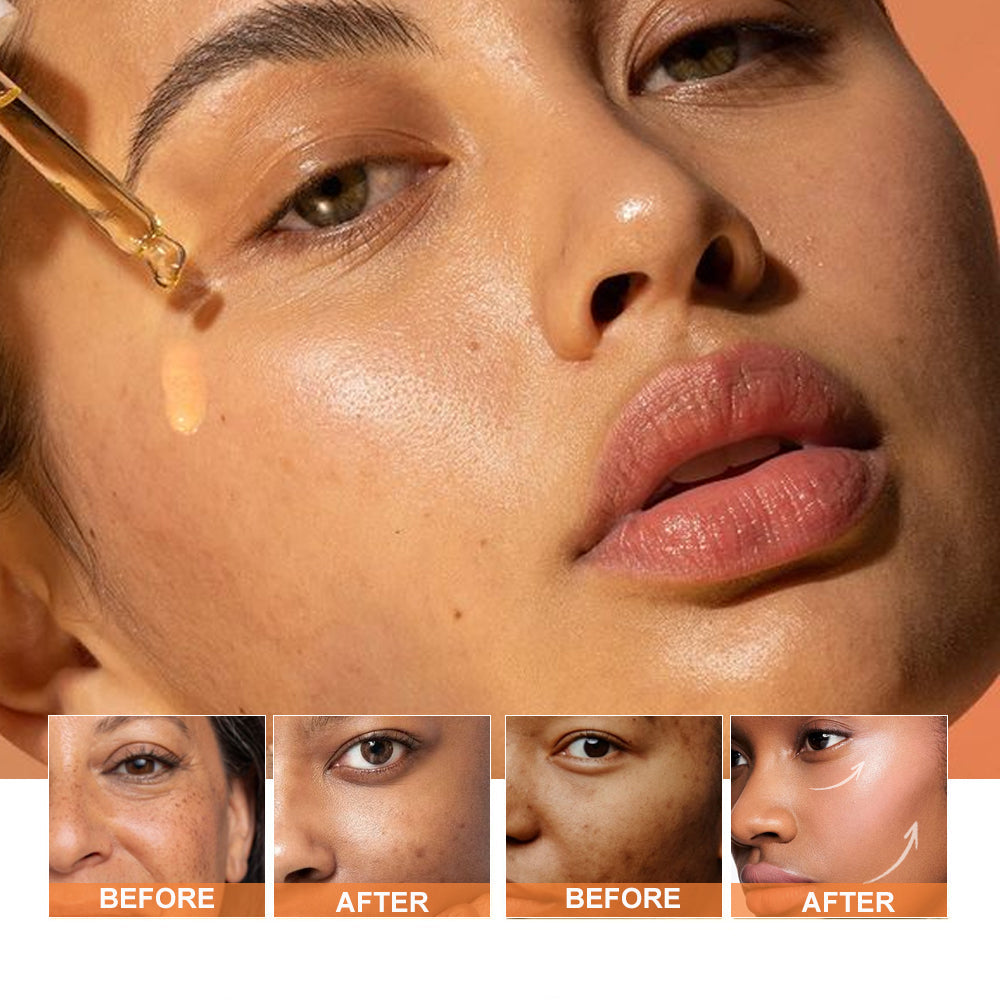 PHISYA Turmeric Brightening Serum – Calming & Repairing Concentrate with Antioxidants for Even-Toned, Glowing Skin PHISYA