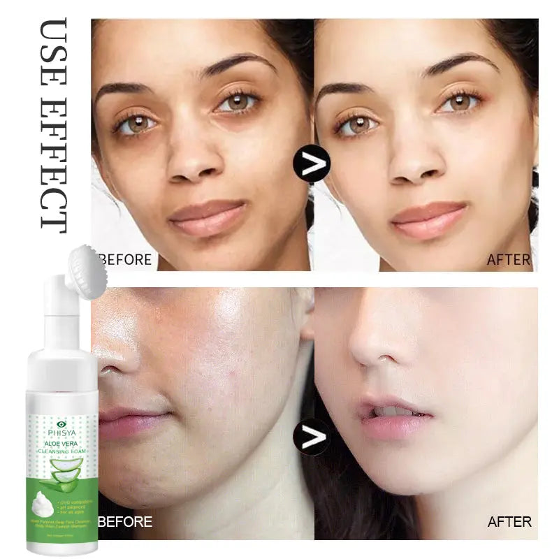 PHISYA Aloe Vera Cleansing Foam – Gentle pH-Balanced Face Wash with Built-In Brush, Multi-Purpose Deep Cleanser PHISYA