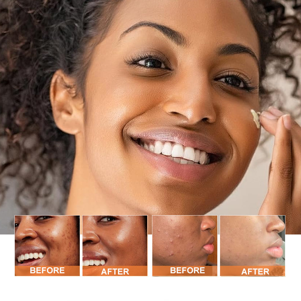 Revitalize your skin with PHISYA Turmeric Face Cream, a soothing moisturizer that brightens, hydrates and protects for radiant, healthy skin.