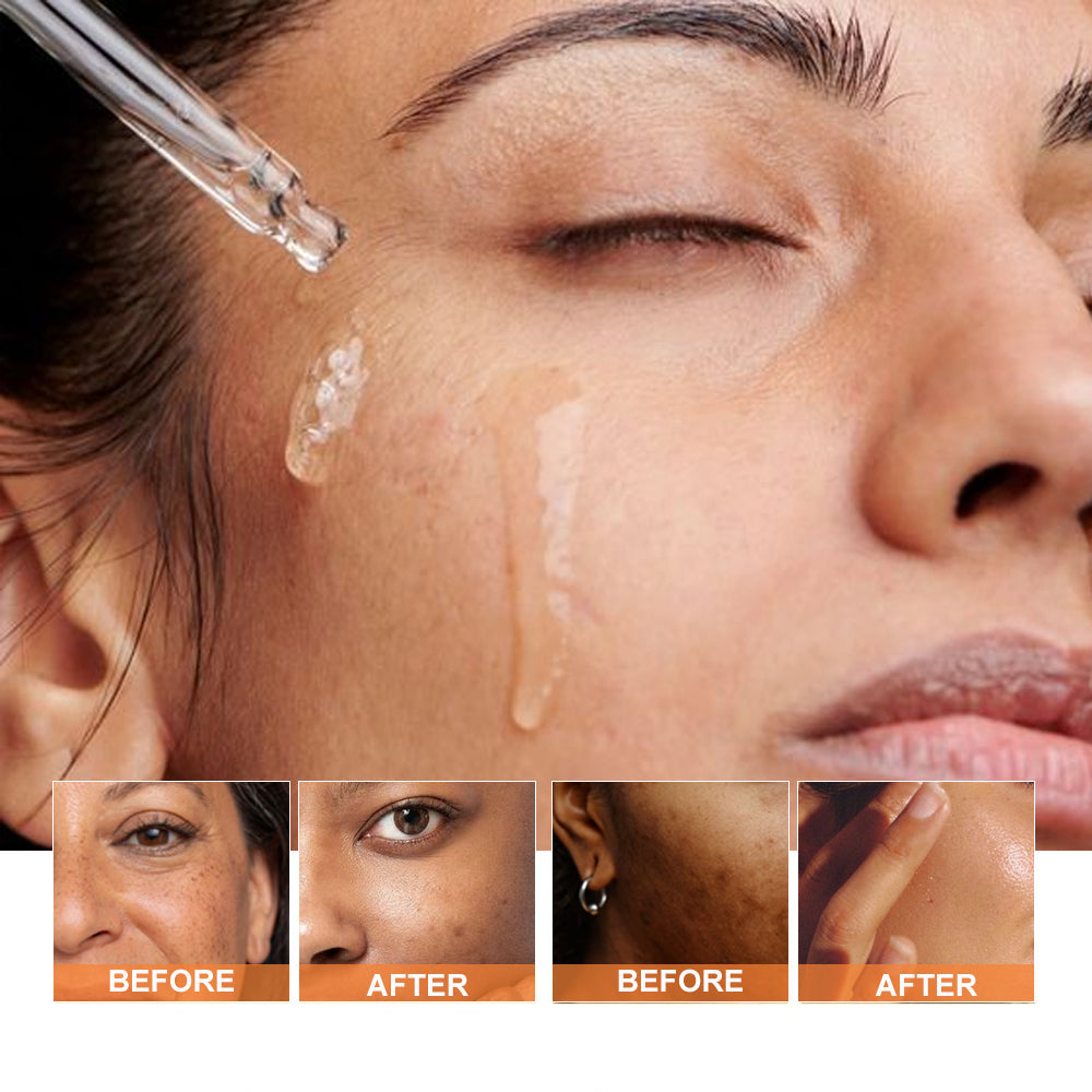 Restore youthful radiance with PHISYA Turmeric Face Oil, your natural anti-aging solution. Hydrate, nourish, and reduce fine lines today!