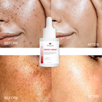 Brighten and firm your skin with PHISYA's Whitening Essence Anti-Aging Serum, infused with collagen and hyaluronic acid. Enjoy 20% off today!